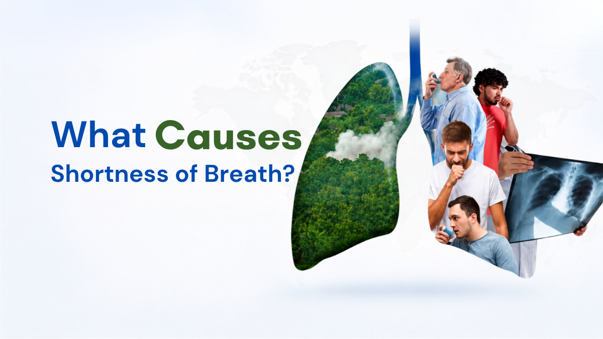 Best pulmonologist in Hyderabad
