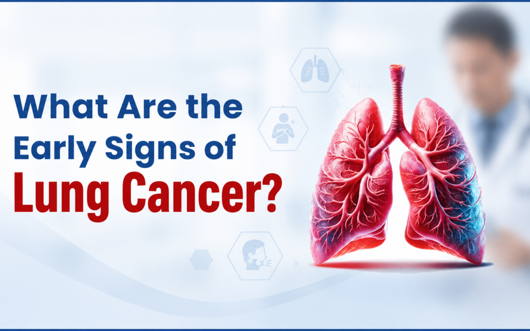 What Are the Early Signs of Lung Cancer?